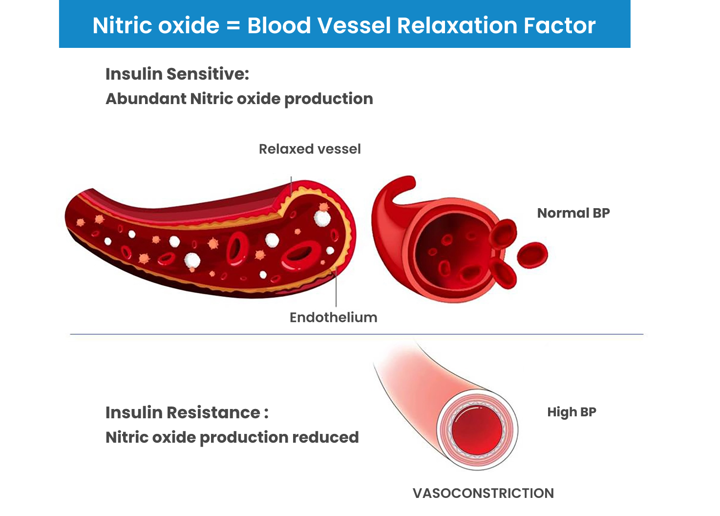 HYPERTENSION